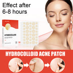 Hydrocolloid Acne Patches - Invisible Pimple Patches 144 Count