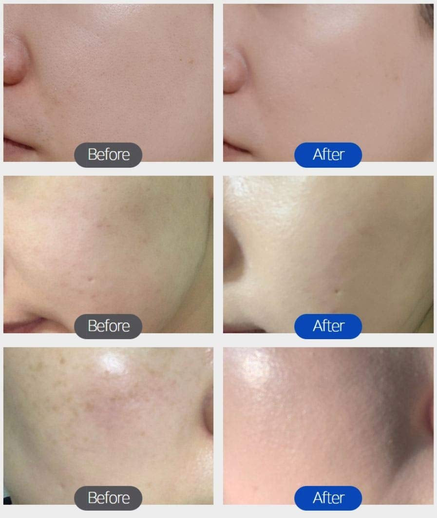 Aesthetic BB Cream H+ Formula SPF40+ PA++ for Dry Skin 