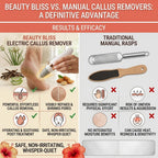 Rechargeable Electric Callus Remover & Foot Grinder
