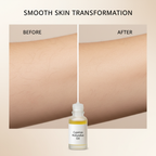 Before After Results